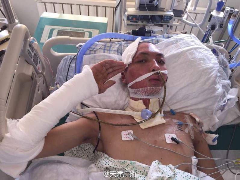 Firefighter who fell into coma in Tianjin blast 
wakes up after a month