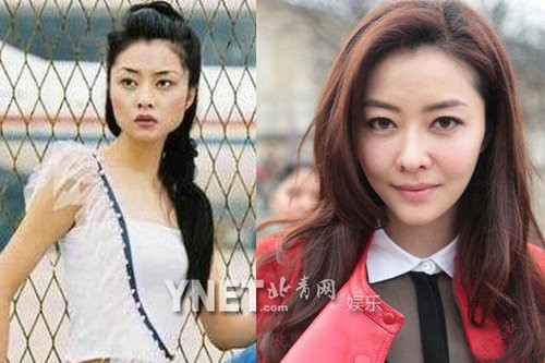 China to be the third largest country of plastic surgery