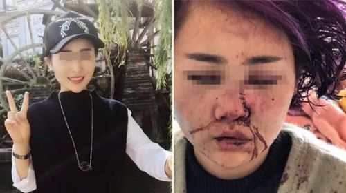 Female tourist attacked in Lijiang